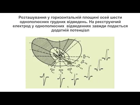 Розташування у горизонтальній площині осей шести однополюсних грудних відведень. На реєструючий електрод