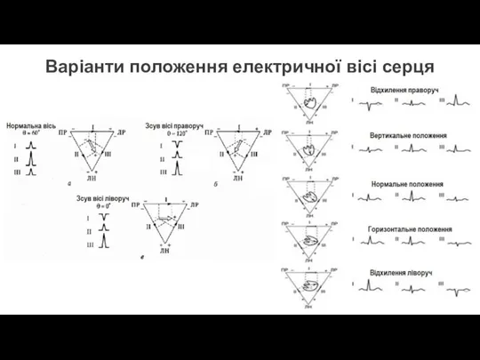 Варіанти положення електричної вісі серця