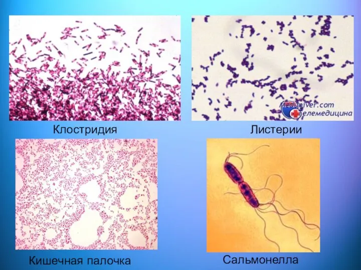 Листерии Кишечная палочка Клостридия Сальмонелла