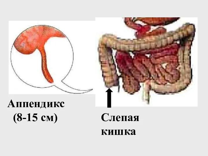 Слепая кишка Аппендикс (8-15 см)