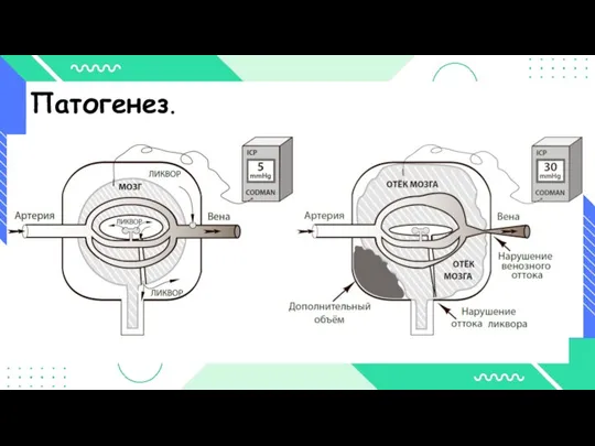 Патогенез.