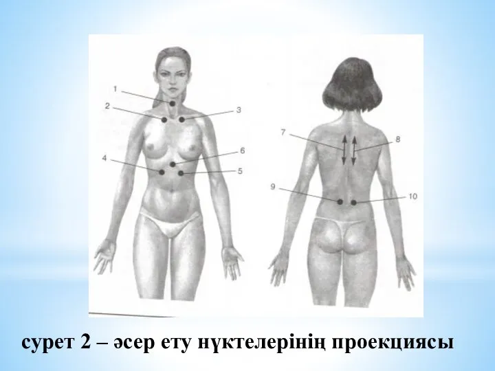 сурет 2 – әсер ету нүктелерінің проекциясы