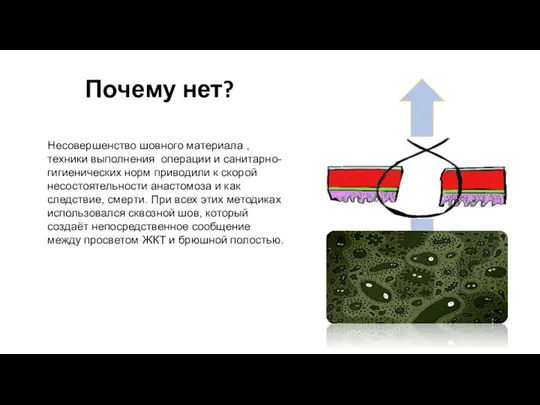 Почему нет? Несовершенство шовного материала , техники выполнения операции и санитарно-гигиенических норм