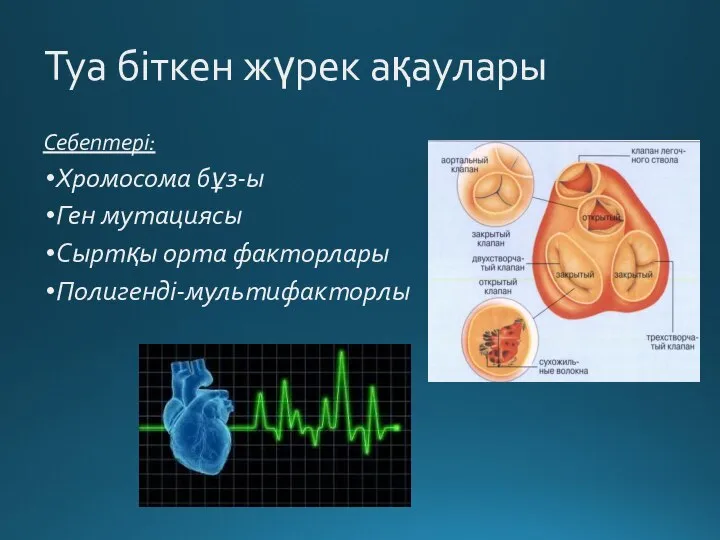 Туа біткен жүрек ақаулары Себептері: Хромосома бұз-ы Ген мутациясы Сыртқы орта факторлары Полигенді-мультифакторлы