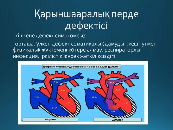 Қарыншааралық перде дефектісі кішкене дефект симптомсыз. орташа, үлкен дефект соматикалық дамудың кешігуі