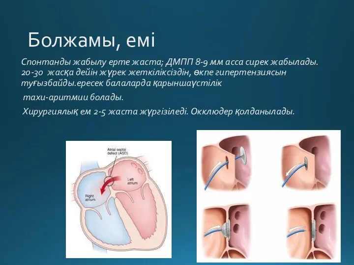 Болжамы, емі Спонтанды жабылу ерте жаста; ДМПП 8-9 мм асса сирек жабылады.