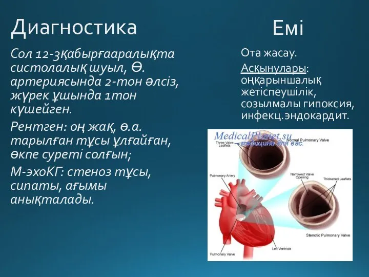 Диагностика Сол 12-3қабырғааралықта систолалық шуыл, Ө.артериясында 2-тон әлсіз, жүрек ұшында 1тон күшейген.