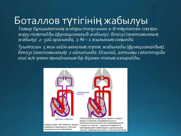 Боталлов түтігінің жабылуы Тамыр бұлшықетінің жоғары тонусынан 1–8 тәуліктен соң қан жүру