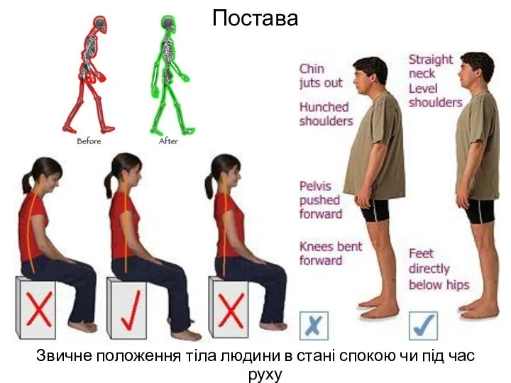 Постава Звичне положення тіла людини в стані спокою чи під час руху