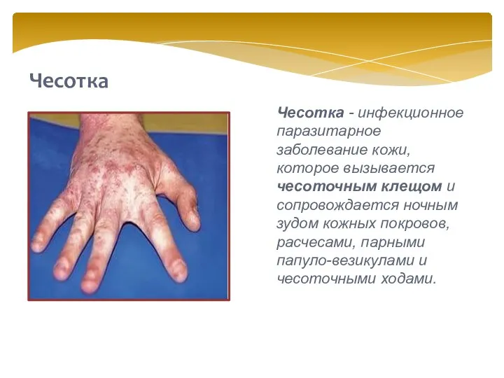 Чесотка Чесотка - инфекционное паразитарное заболевание кожи, которое вызывается чесоточным клещом и