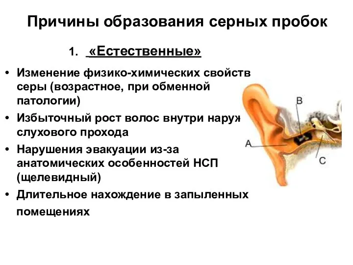 «Естественные» Изменение физико-химических свойств серы (возрастное, при обменной патологии) Избыточный рост волос