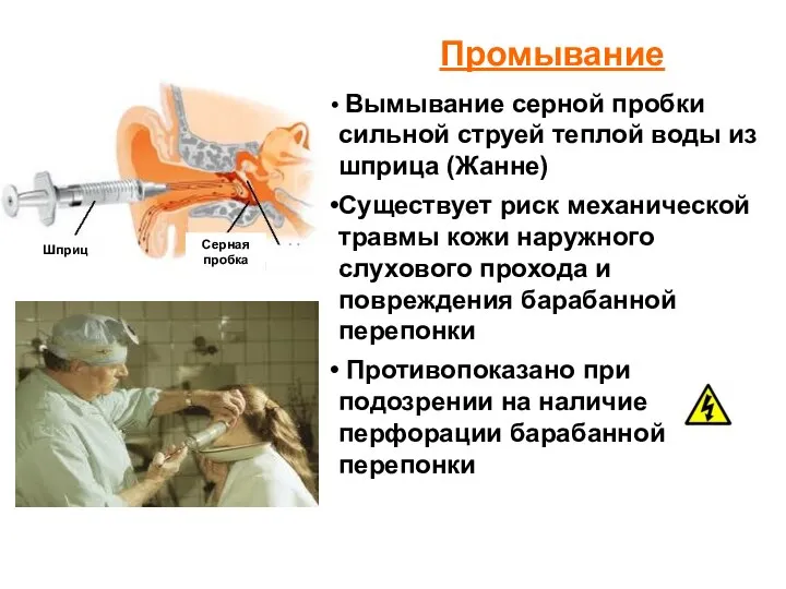 Промывание Вымывание серной пробки сильной струей теплой воды из шприца (Жанне) Существует