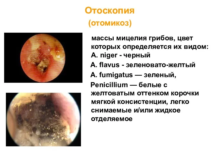 массы мицелия грибов, цвет которых определяется их видом: A. niger - черный