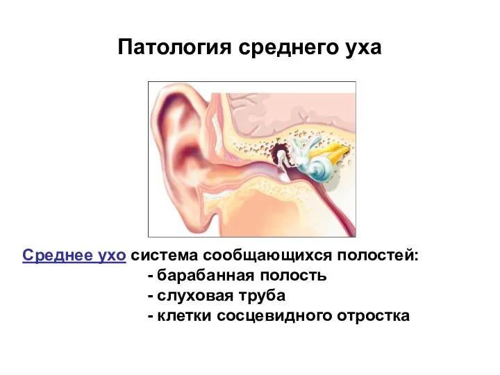 Патология среднего уха Среднее ухо система сообщающихся полостей: - барабанная полость -