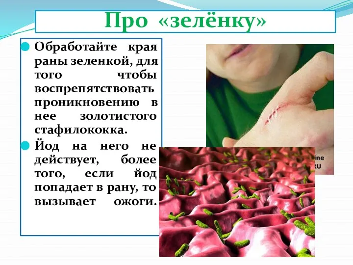 Про «зелёнку» Обработайте края раны зеленкой, для того чтобы воспрепятствовать проникновению в