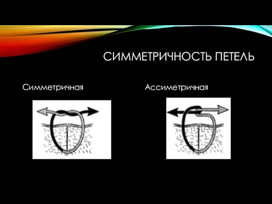 СИММЕТРИЧНОСТЬ ПЕТЕЛЬ Симметричная Ассиметричная