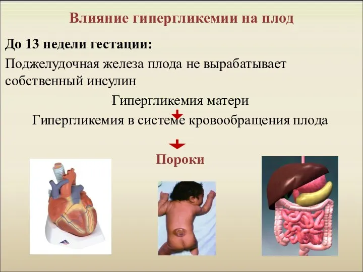 Влияние гипергликемии на плод До 13 недели гестации: Поджелудочная железа плода не