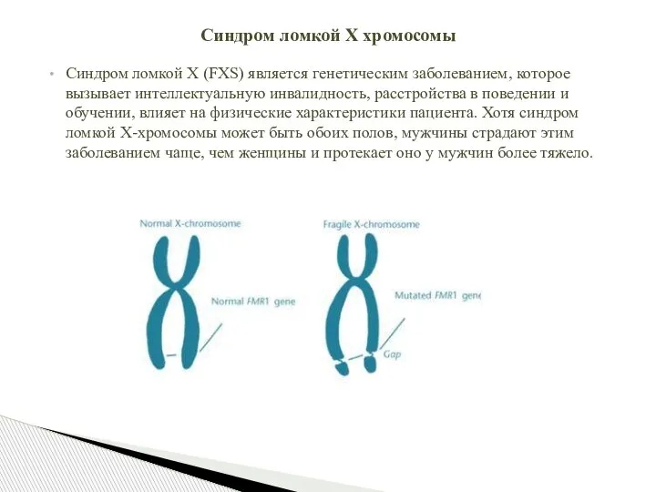 Синдром ломкой Х (FXS) является генетическим заболеванием, которое вызывает интеллектуальную инвалидность, расстройства