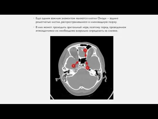 Еще одним важным элементом являются клетки Оноди – задние решетчатые клетки, распространившиеся