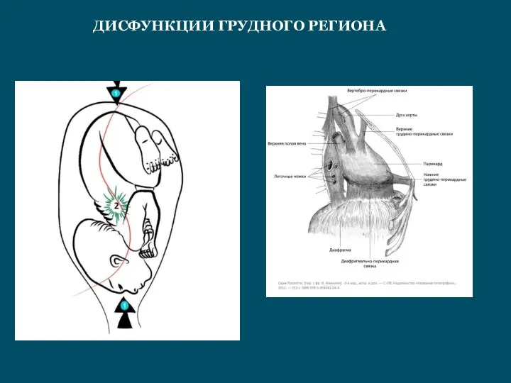 ДИСФУНКЦИИ ГРУДНОГО РЕГИОНА