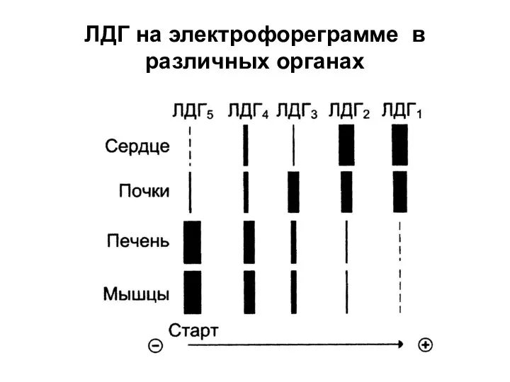 ЛДГ на электрофореграмме в различных органах