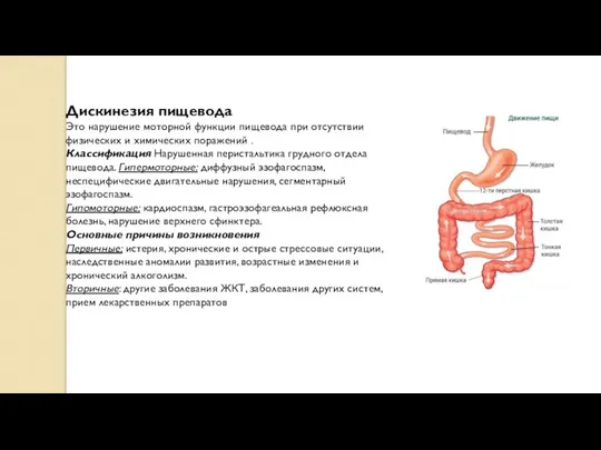 Дискинезия пищевода Это нарушение моторной функции пищевода при отсутствии физических и химических