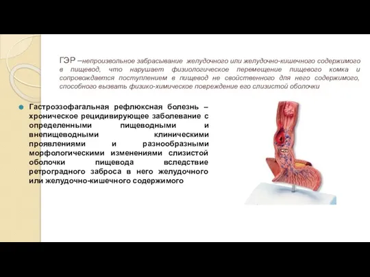 ГЭР –непроизвольное забрасывание желудочного или желудочно-кишечного содержимого в пищевод, что нарушает физиологическое