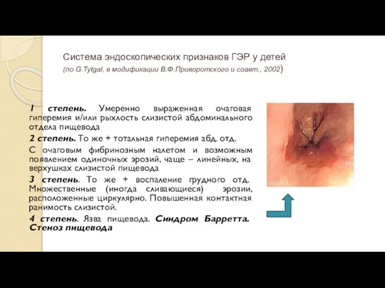 Система эндоскопических признаков ГЭР у детей (по G.Tytgal, в модификации В.Ф.Приворотского и