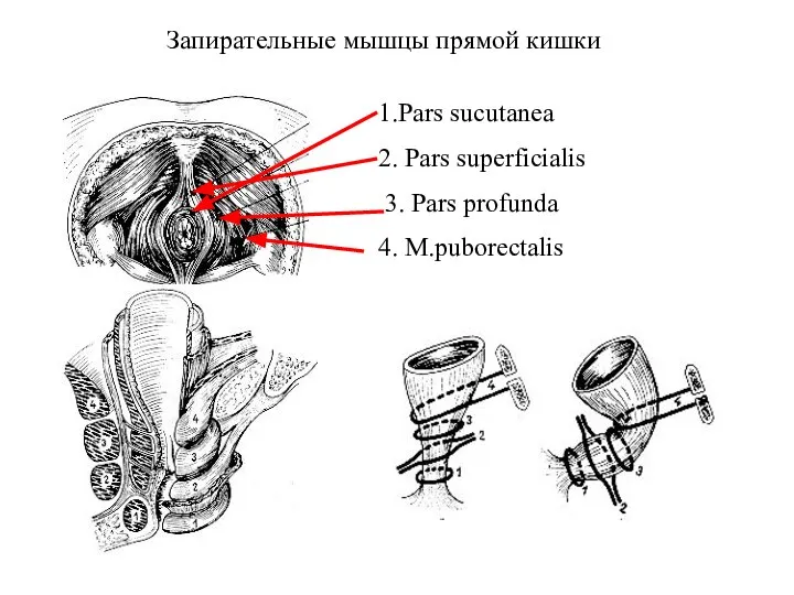Запирательные мышцы прямой кишки 1.Pars sucutanea 2. Pars superficialis 3. Pars profunda 4. M.puborectalis