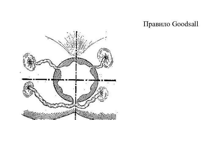 Правило Goodsall