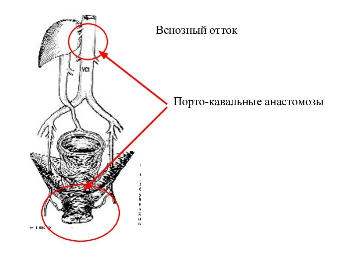 Венозный отток Порто-кавальные анастомозы