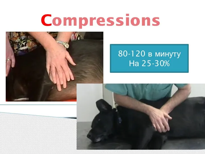 Compressions 80-120 в минуту На 25-30%