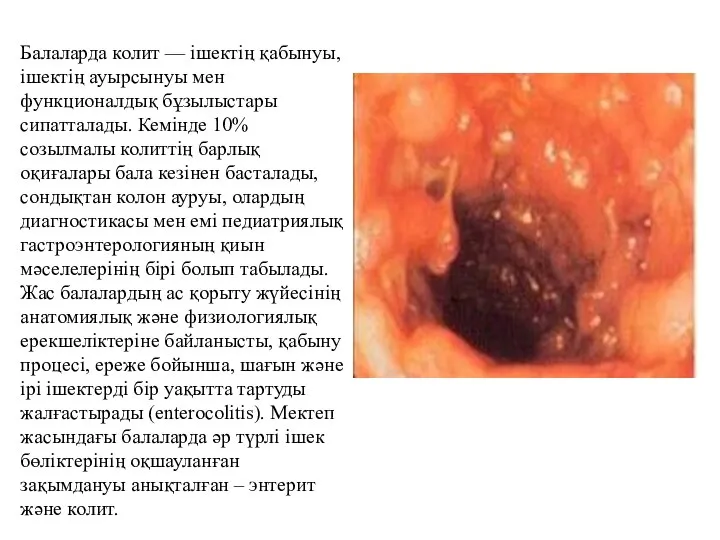 Балаларда колит — ішектің қабынуы, ішектің ауырсынуы мен функционалдық бұзылыстары сипатталады. Кемінде