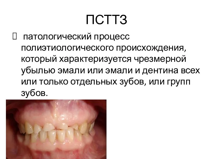 ПСТТЗ патологический процесс полиэтиологического происхождения, который характеризуется чрезмерной убылью эмали или эмали