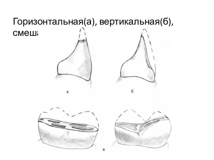 Горизонтальная(а), вертикальная(б), смешанная(в)