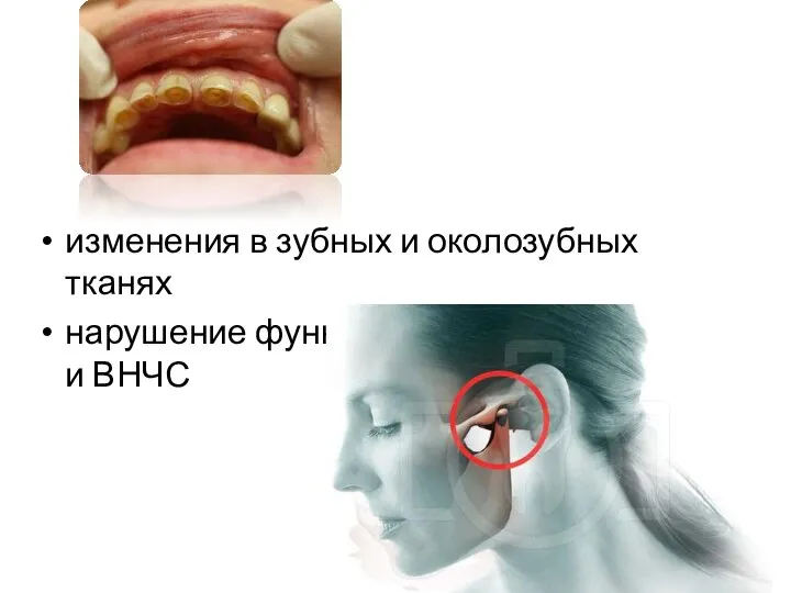 изменения в зубных и околозубных тканях нарушение функции жевательных мышц и ВНЧС