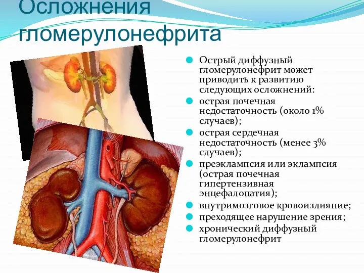 Осложнения гломерулонефрита Острый диффузный гломерулонефрит может приводить к развитию следующих осложнений: острая