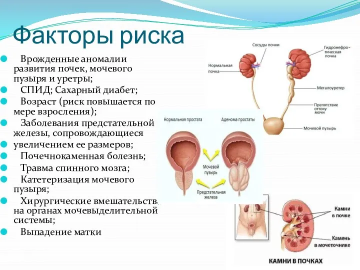 Факторы риска Врожденные аномалии развития почек, мочевого пузыря и уретры; СПИД; Сахарный