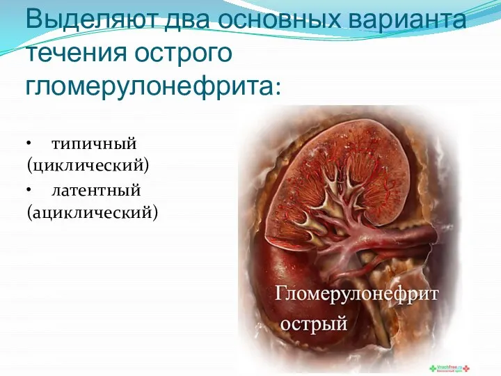 Выделяют два основных варианта течения острого гломерулонефрита: • типичный (циклический) • латентный (ациклический)