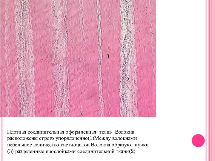 Плотная соединительная оформленная ткань Волокна расположены строго упорядоченно(1)Между волокнами небольшое количество гистиоцитов.Волокна