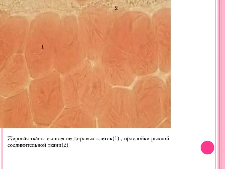 Жировая ткань- скопление жировых клеток(1) , прослойки рыхлой соединительной ткани(2) 1 2