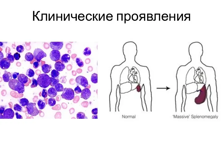 Клинические проявления