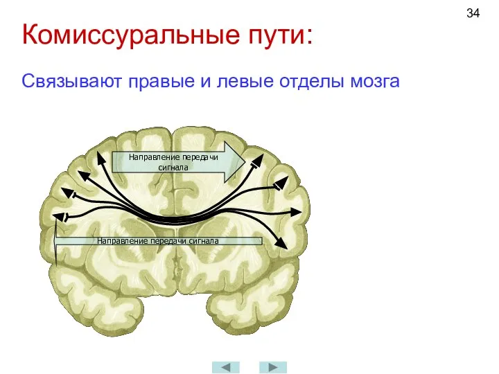 Комиссуральные пути: Связывают правые и левые отделы мозга Направление передачи сигнала Направление передачи сигнала