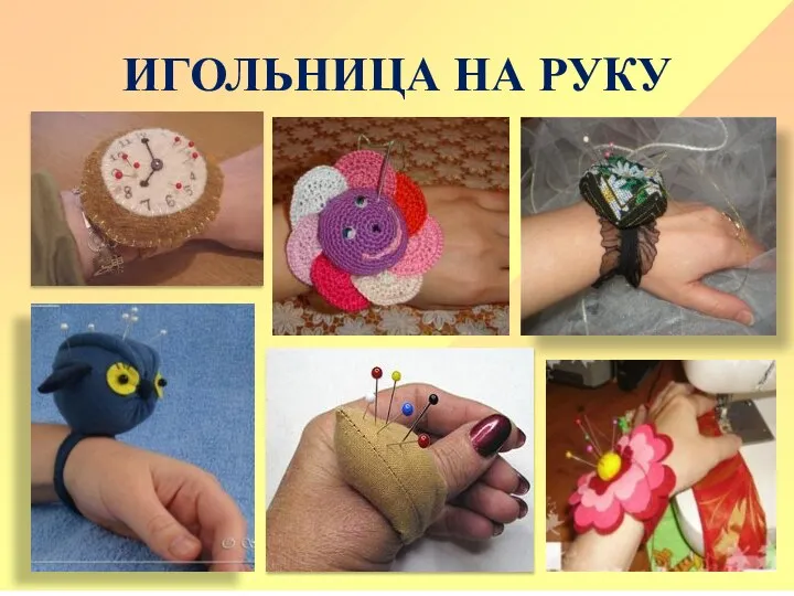 ИГОЛЬНИЦА НА РУКУ