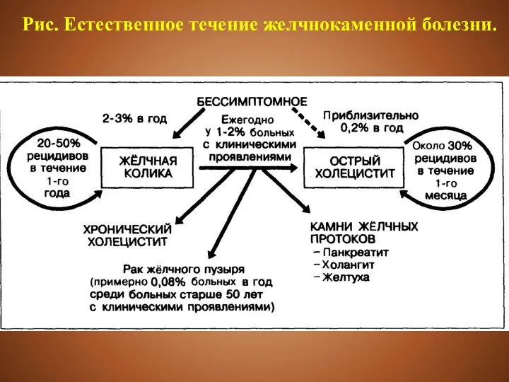 Рис. Естественное течение желчно­каменной болезни.