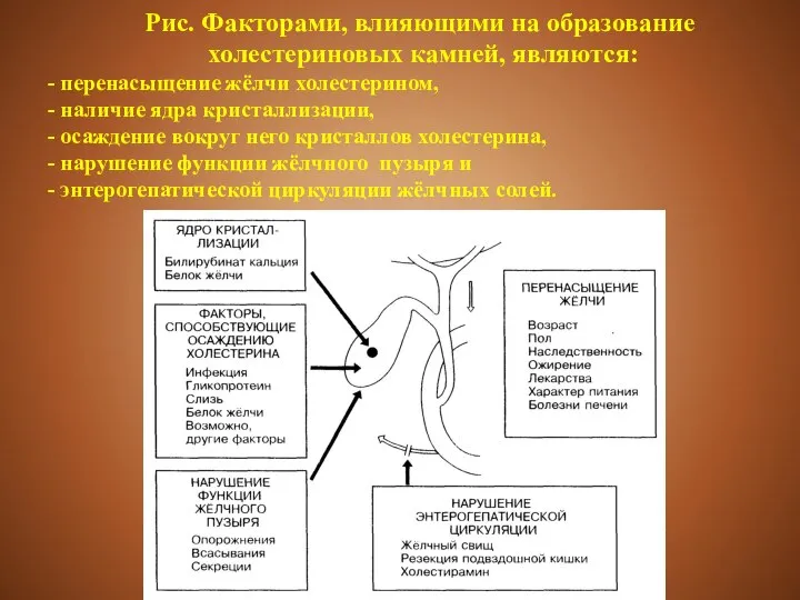 Рис. Факторами, влияющими на образование холестериновых камней, являются: - перенасыщение жёлчи холестерином,