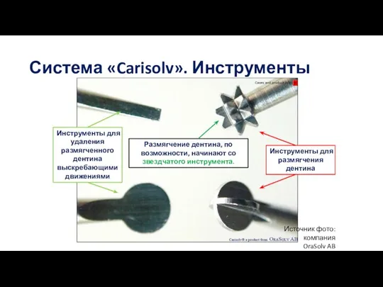 Система «Carisolv». Инструменты Инструменты для размягчения дентина Инструменты для удаления размягченного дентина