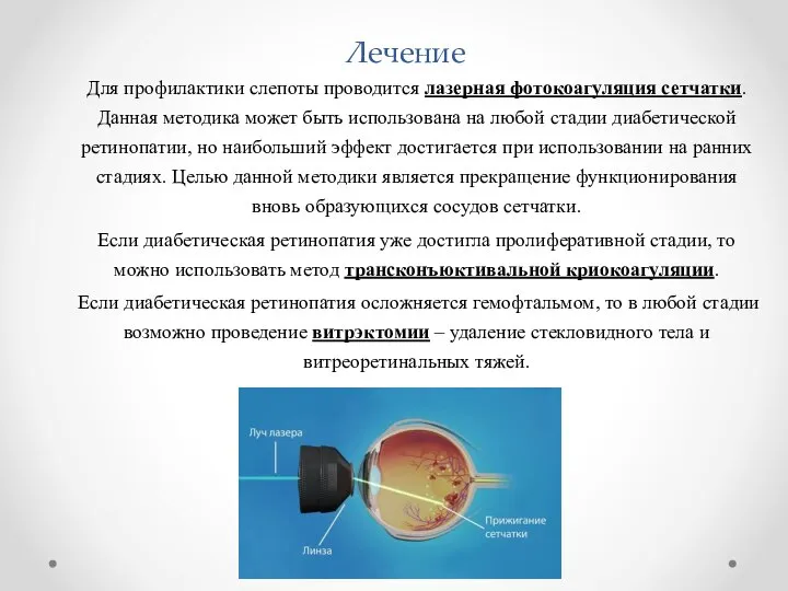 Лечение Для профилактики слепоты проводится лазерная фотокоагуляция сетчатки. Данная методика может быть