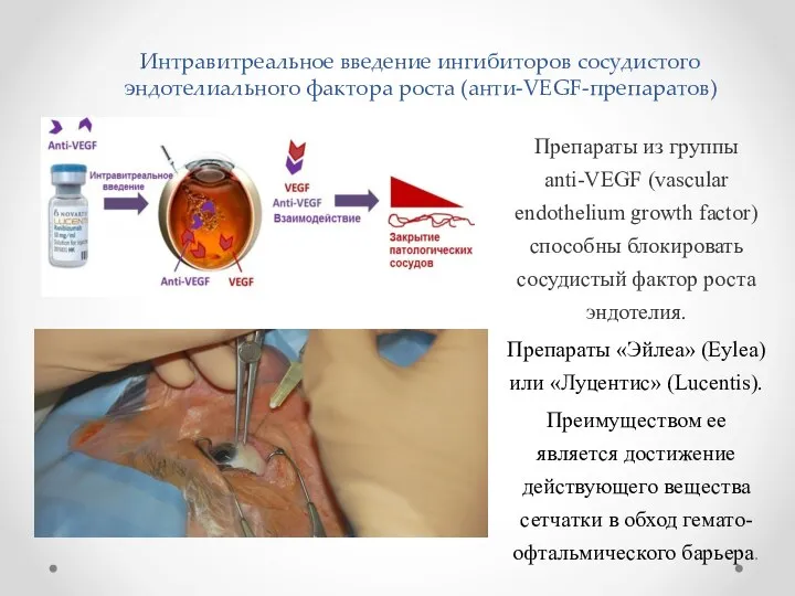 Интравитреальное введение ингибиторов сосудистого эндотелиального фактора роста (анти-VEGF-препаратов) Препараты из группы anti-VEGF