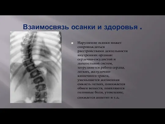 Взаимосвязь осанки и здоровья . Нарушение осанки может сопровождаться расстройствами деятельности внутренних